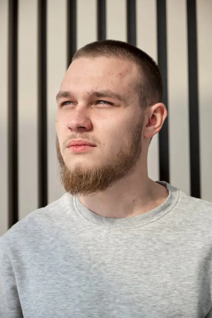 A young man with facial hair gazes thoughtfully, bathed in sunlight against a striped background.