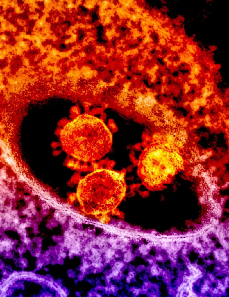 Colorful microscopic image depicting coronavirus particles in vibrant detail.
